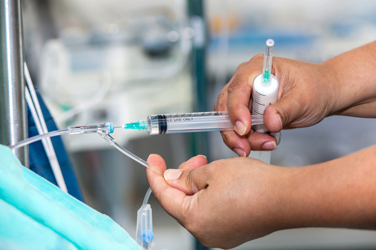 そもそも全身麻酔とは？